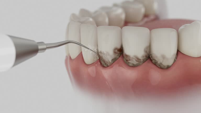 Trusted Dental Implants service in Portales, NM - Dentist Open Now
